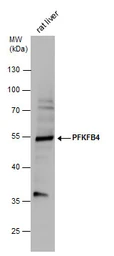 Anti-PFKFB4 antibody used in Western Blot (WB). GTX107755