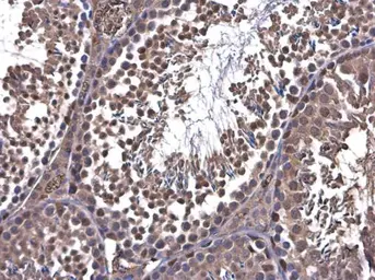 Anti-PFKFB4 antibody used in IHC (Paraffin sections) (IHC-P). GTX107755