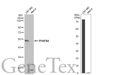 Anti-PFKFB4 antibody used in Western Blot (WB). GTX107755