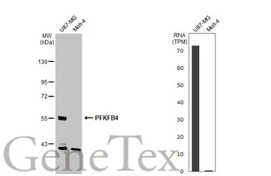 Anti-PFKFB4 antibody used in Western Blot (WB). GTX107755