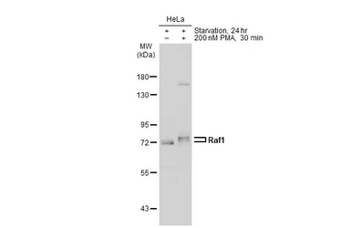 Anti-Raf1 antibody [N3C3] used in Western Blot (WB). GTX107763