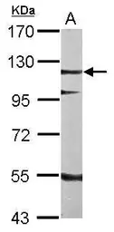 Anti-SRPK2 antibody [N3C3] used in Western Blot (WB). GTX107774
