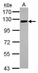 Anti-SRPK2 antibody [N3C3] used in Western Blot (WB). GTX107774