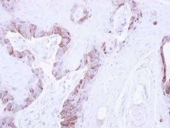 Anti-LIM kinase 2 antibody used in IHC (Paraffin sections) (IHC-P). GTX107784