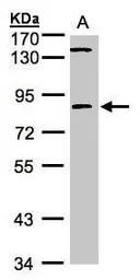 Anti-LIM kinase 2 antibody used in Western Blot (WB). GTX107784
