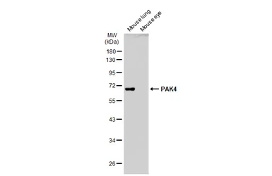 Anti-PAK4 antibody [C1C3] used in Western Blot (WB). GTX107787