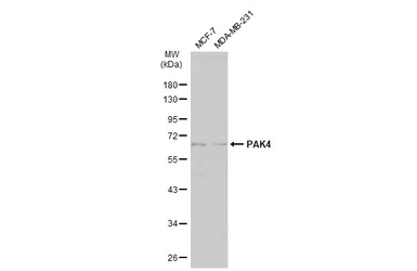 Anti-PAK4 antibody [C1C3] used in Western Blot (WB). GTX107787