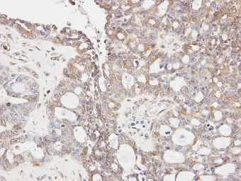 Anti-GLYCTK antibody [N3C3] used in IHC (Paraffin sections) (IHC-P). GTX107807