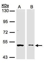 Anti-GLYCTK antibody [N3C3] used in Western Blot (WB). GTX107807