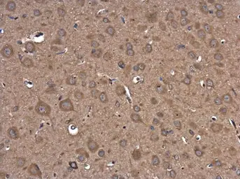 Anti-PI3 kinase p101 antibody [C2C3-2], C-term used in IHC (Paraffin sections) (IHC-P). GTX107813