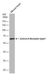 Anti-Activin Receptor Type IA antibody used in Western Blot (WB). GTX107815