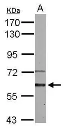 Anti-Activin Receptor Type IA antibody used in Western Blot (WB). GTX107815