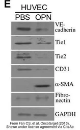 Anti-TIE1 antibody used in Western Blot (WB). GTX107818