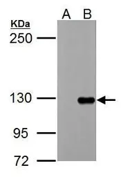 Anti-TIE1 antibody used in Western Blot (WB). GTX107818