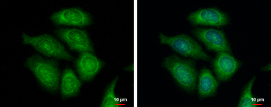 Anti-FASTKD1 antibody [C1C3] used in Immunocytochemistry/ Immunofluorescence (ICC/IF). GTX107835