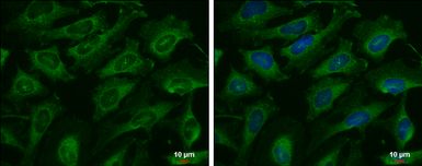 Anti-AK8 antibody [N3C3] used in Immunocytochemistry/ Immunofluorescence (ICC/IF). GTX107840