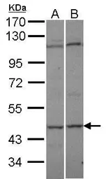 Anti-AK8 antibody [N3C3] used in Western Blot (WB). GTX107840