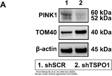 Anti-PINK1 antibody [N3C3] used in Western Blot (WB). GTX107851