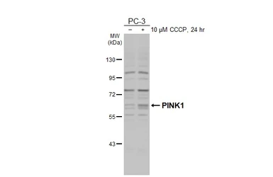 Anti-PINK1 antibody [N3C3] used in Western Blot (WB). GTX107851