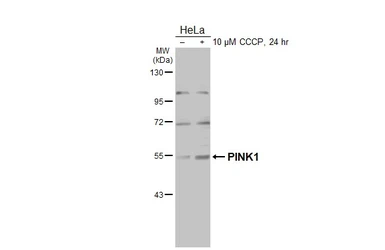 Anti-PINK1 antibody [N3C3] used in Western Blot (WB). GTX107851