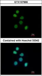 Anti-FES antibody [C1C3] used in Immunocytochemistry/ Immunofluorescence (ICC/IF). GTX107866