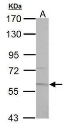 Anti-Pyruvate Kinase (liver/RBC) antibody used in Western Blot (WB). GTX107873