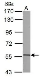 Anti-Pyruvate Kinase (liver/RBC) antibody used in Western Blot (WB). GTX107873