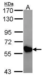 Anti-CKMT2 antibody [N3C3] used in Western Blot (WB). GTX107874