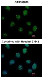 Anti-IP6K2 antibody used in Immunocytochemistry/ Immunofluorescence (ICC/IF). GTX107886