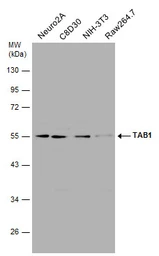Anti-TAB1 antibody used in Western Blot (WB). GTX107892