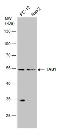 Anti-TAB1 antibody used in Western Blot (WB). GTX107892