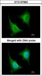 Anti-TAB1 antibody used in Immunocytochemistry/ Immunofluorescence (ICC/IF). GTX107892