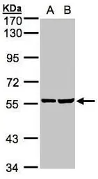 Anti-TAB1 antibody used in Western Blot (WB). GTX107892