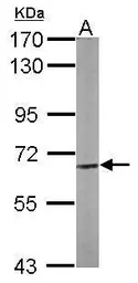 Anti-Copine 3 antibody [N3C3] used in Western Blot (WB). GTX107896