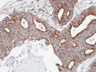 Anti-Copine 3 antibody [N3C3] used in IHC (Paraffin sections) (IHC-P). GTX107896