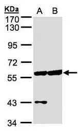 Anti-Copine 3 antibody [N3C3] used in Western Blot (WB). GTX107896