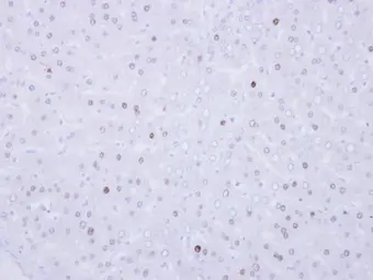Anti-VRK1 antibody used in IHC (Paraffin sections) (IHC-P). GTX107899