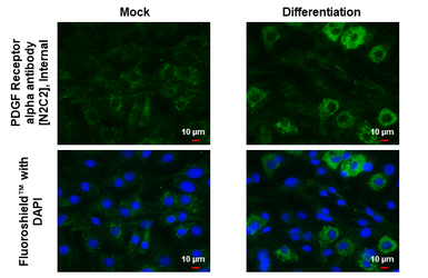Anti-PDGF Receptor alpha antibody [N2C2], Internal used in Immunocytochemistry/ Immunofluorescence (ICC/IF). GTX107903