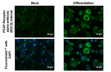 Anti-PDGF Receptor alpha antibody [N2C2], Internal used in Immunocytochemistry/ Immunofluorescence (ICC/IF). GTX107903