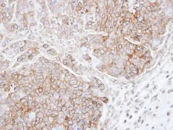 Anti-CSK antibody used in IHC (Paraffin sections) (IHC-P). GTX107916