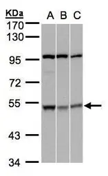 Anti-CSK antibody used in Western Blot (WB). GTX107916