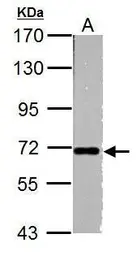 Anti-Nucleoporin p62 antibody used in Western Blot (WB). GTX107920