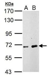 Anti-Nucleoporin p62 antibody used in Western Blot (WB). GTX107920