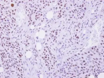Anti-Selenophosphate synthetase 1 antibody used in IHC (Paraffin sections) (IHC-P). GTX107924
