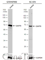 Anti-ZAP70 antibody used in Western Blot (WB). GTX107950