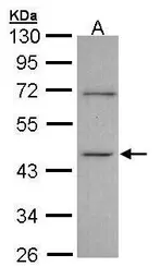 Anti-ITPK1 antibody [N3C3] used in Western Blot (WB). GTX107974