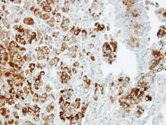Anti-Importin 13 antibody [C3], C-term used in IHC (Paraffin sections) (IHC-P). GTX107982