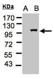 Anti-Importin 13 antibody [C3], C-term used in Western Blot (WB). GTX107982