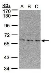 Anti-EPM2AIP1 antibody [N1], N-term used in Western Blot (WB). GTX107983