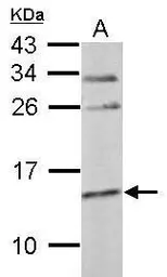 Anti-Cystatin C antibody used in Western Blot (WB). GTX107986